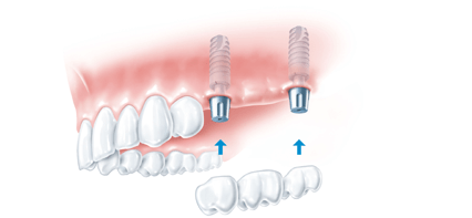 Ropergate Dental Care & Implant Studio in Pontefract