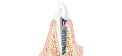 Ropergate Dental Care & Implant Studio in Pontefract