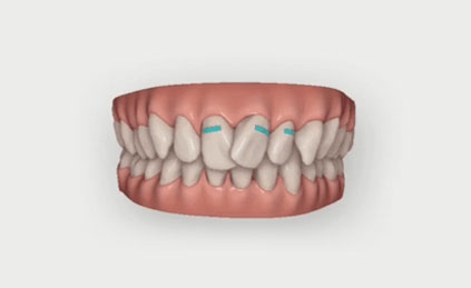 Ropergate Dental Care & Implant Studio in Pontefract