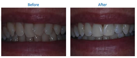 Ropergate Dental Care & Implant Studio in Pontefract