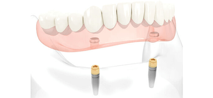 Ropergate Dental Care & Implant Studio in Pontefract