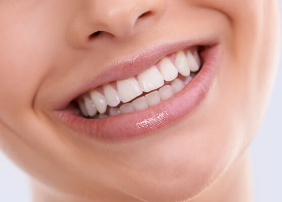 Woman with braces smiling