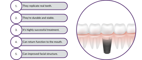 Dental implant benefits diagram in Pontefract