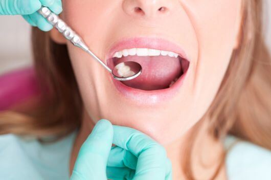 woman having a dental examination to see if she's eligible for composite bonding