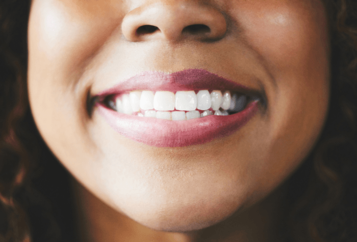 Woman smiling after dental implants